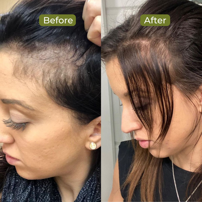 Premium Batana Oil For Hair Growth