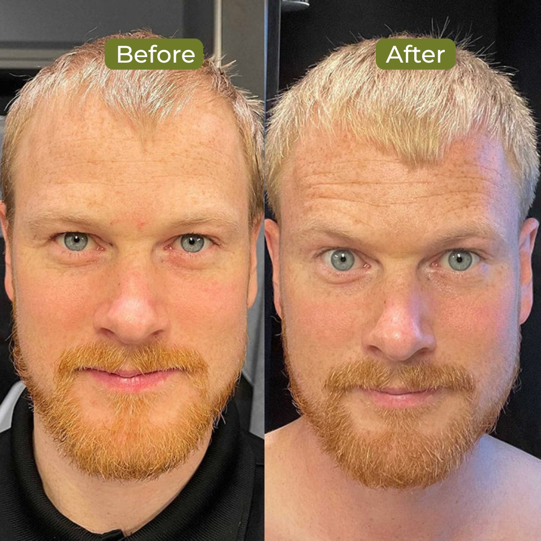 Premium Batana Oil For Hair Growth